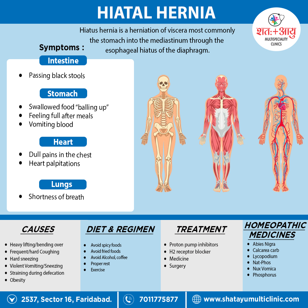 Hiatal Hernia Shatayu Multi Speciality Clinic