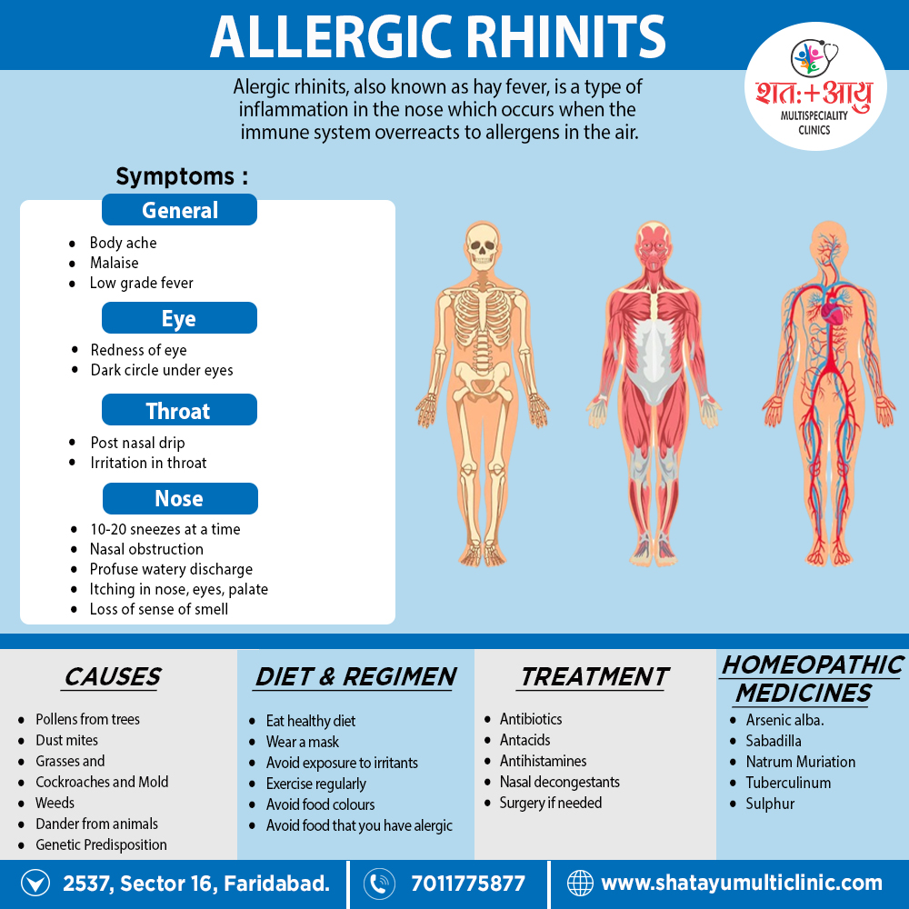 allergic rhinitis poster