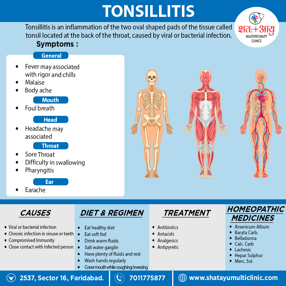 tonsillitis-shatayu-multi-speciality-clinic