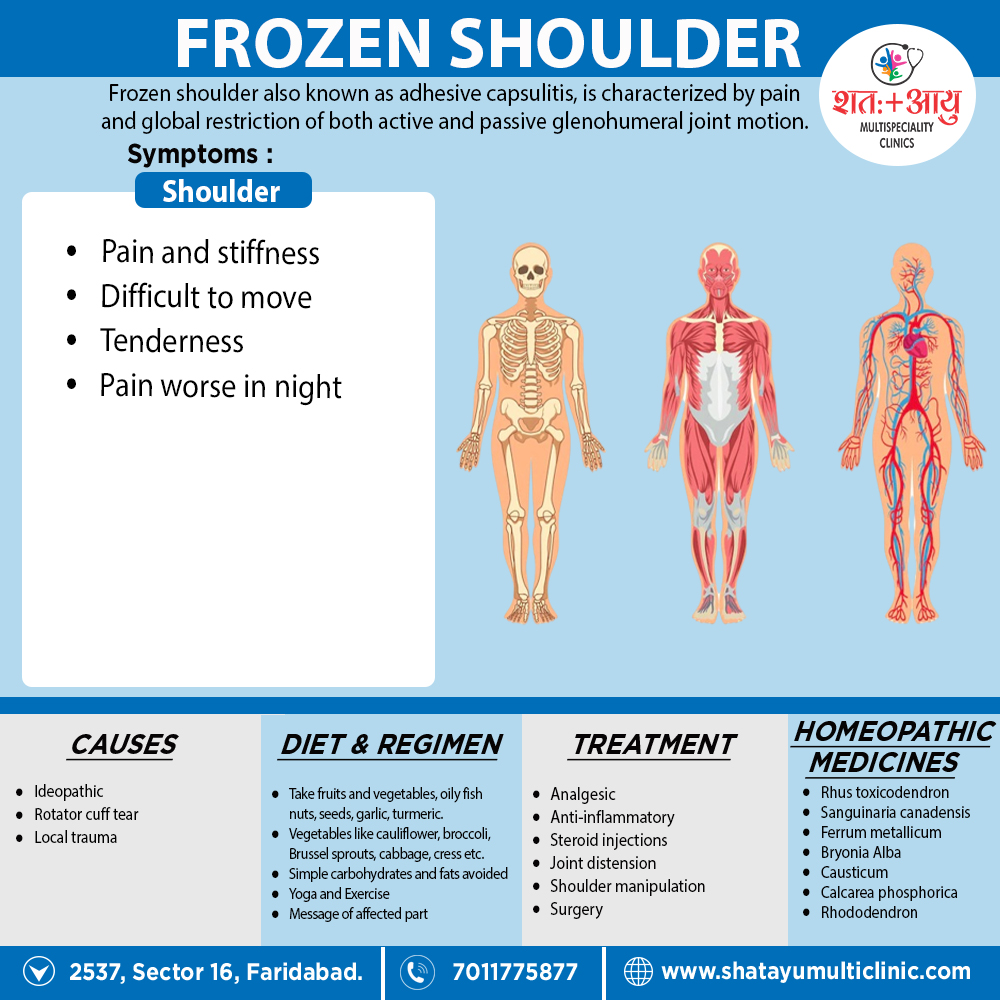 frozen-shoulder-syndrome-osteo-health-osteopath-clinic-in-calgary