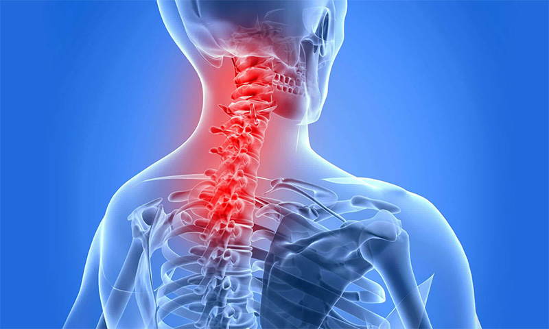 AnkylosingSpondylitis